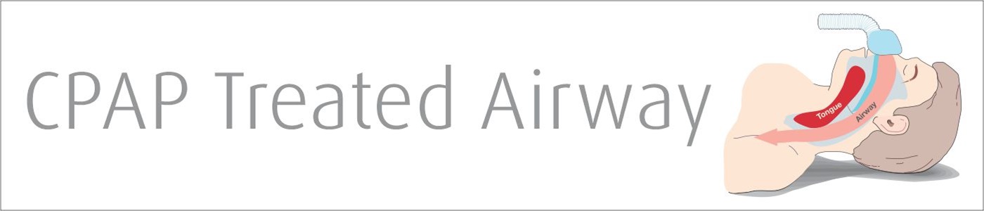 CPAP Treated Airway