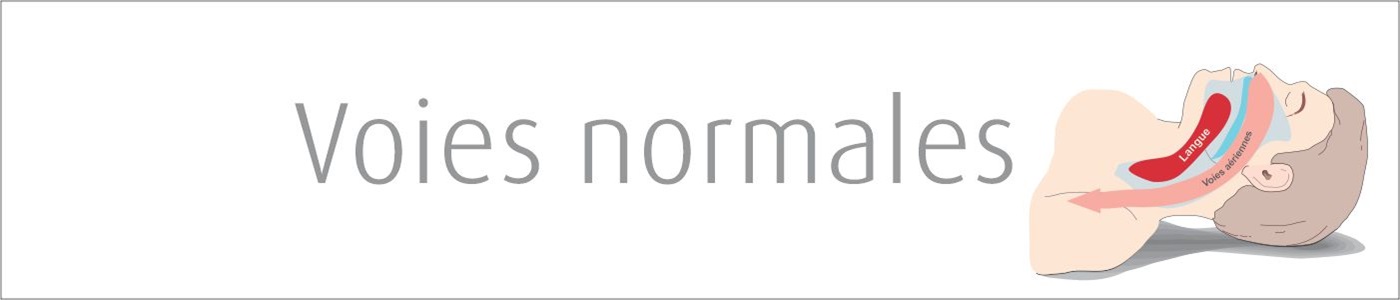 Normal Airway - Voies normales